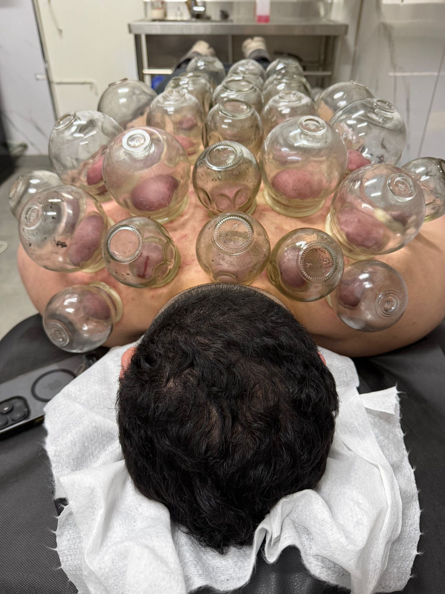 טיפול חיג'מה