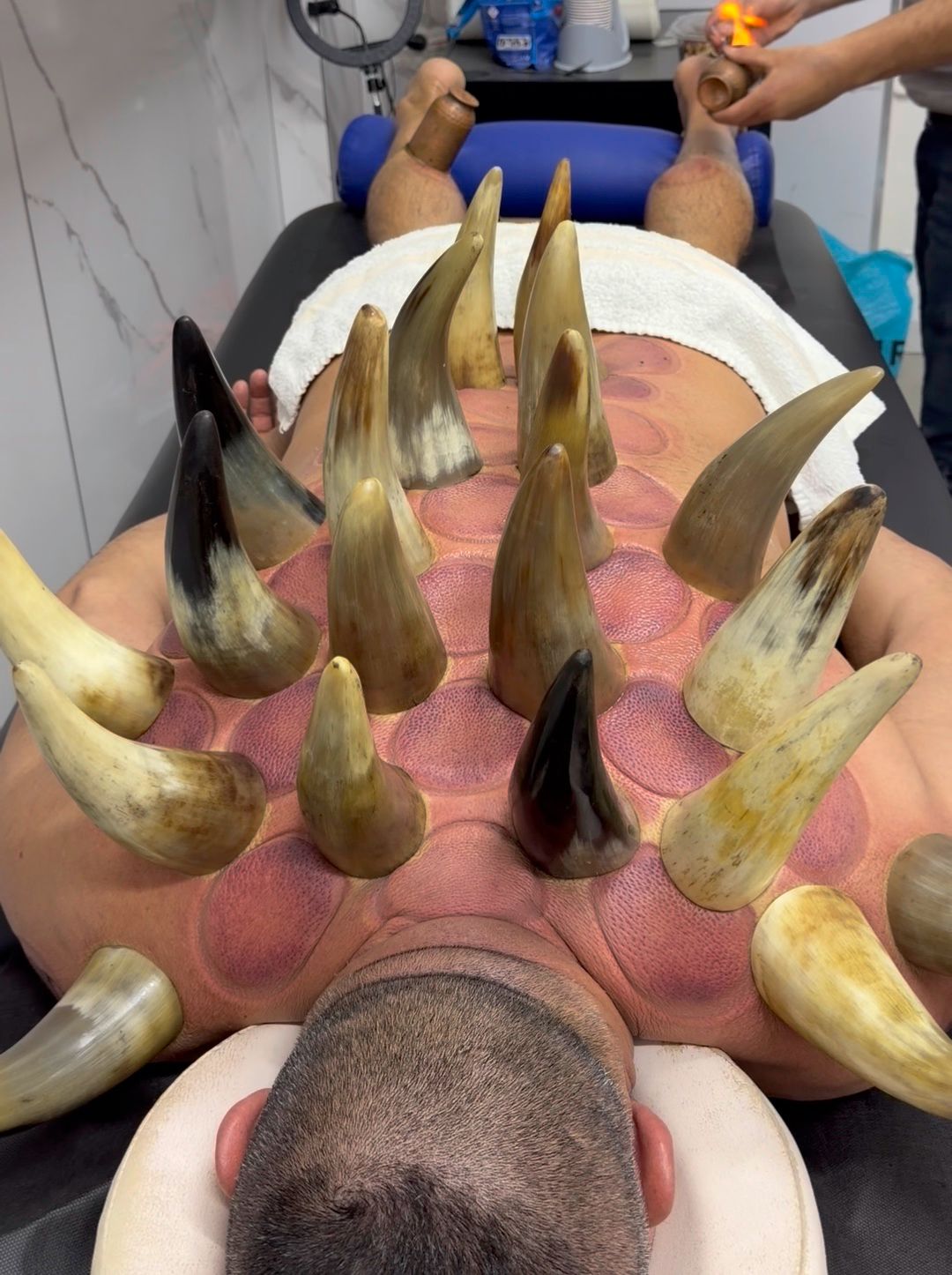 טיפול מסורתי